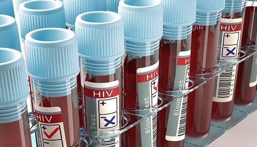HIV Risk Higher Among Women Due to Greater Risk Behaviors