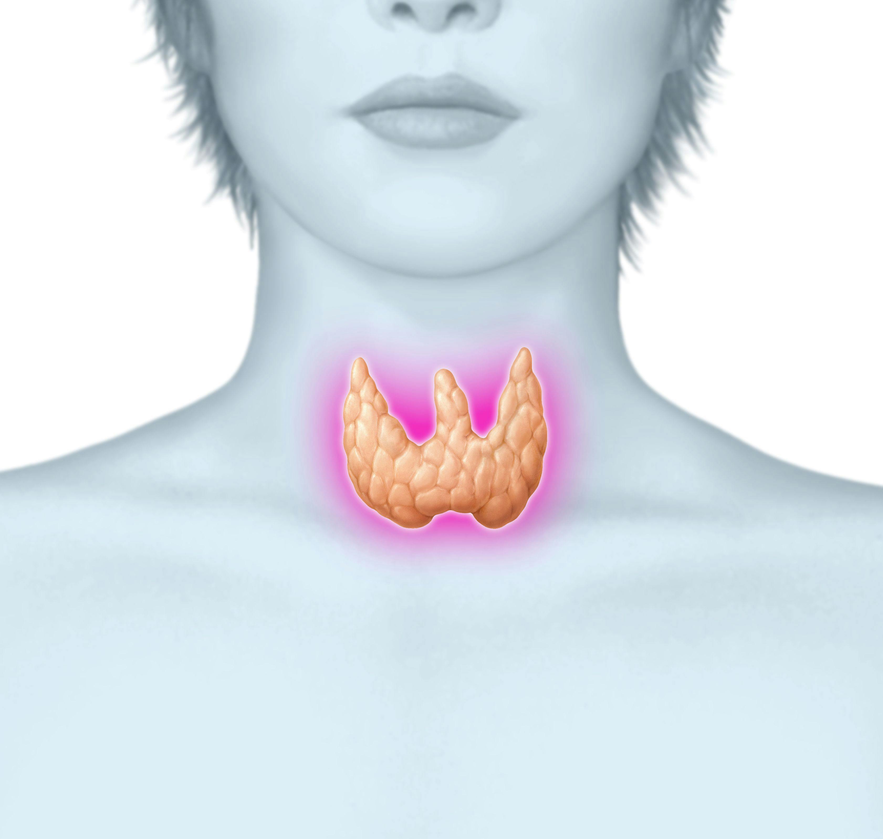 Treatment Doesn't Improve Subclinical Hypothyroidism Symptoms
