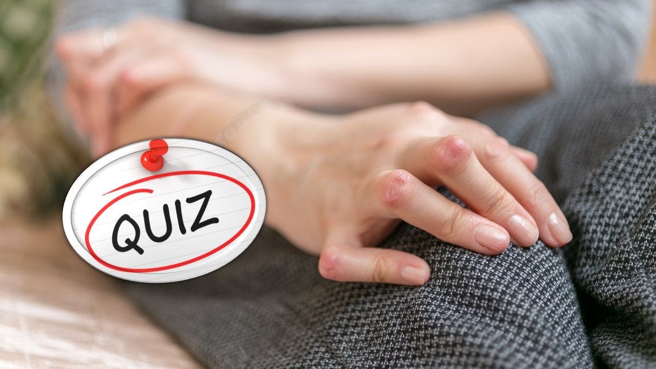 rheumatoid arthritis treat to target quiz