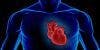Cardiac Disorder May Affect Broader Range of Patients Than Previously Reported
