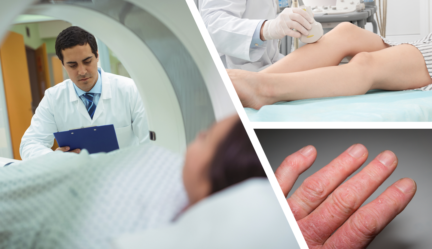 Diagnostic Imaging Shows Increasing Promise for Improving Diagnosis and Care of Psoriatic Arthritis 