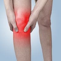 Day-to-Day Knee Pain in Osteoarthritis May Depend on Genetics