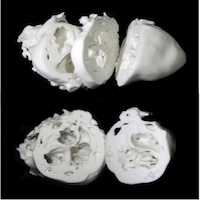 3-D Printed Heart Models on the Rise