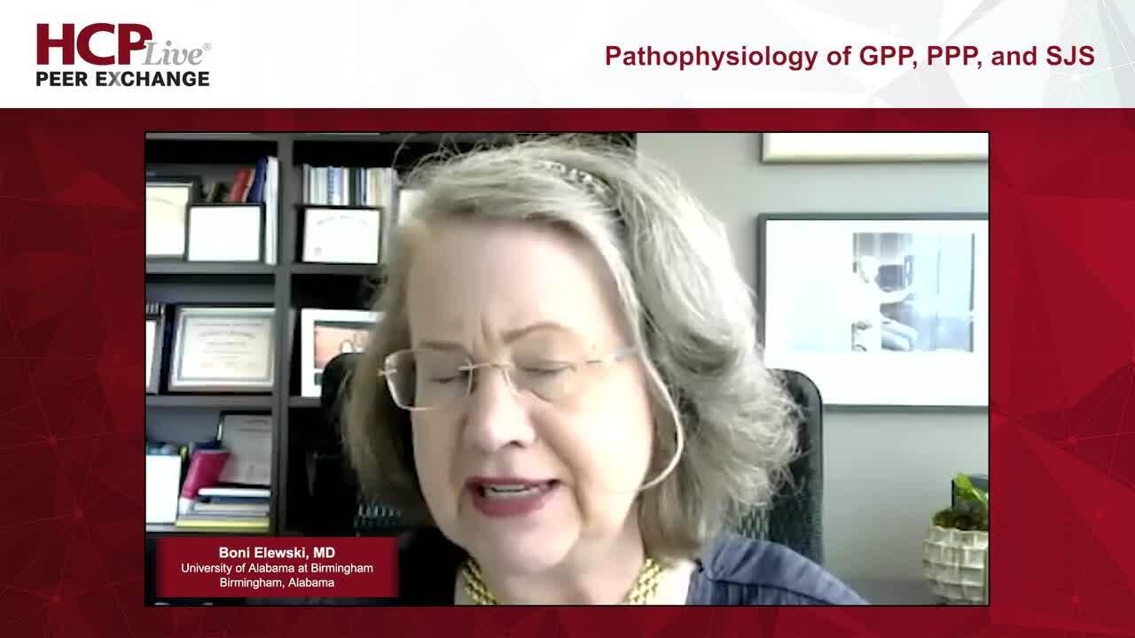 Pathophysiology of GPP, PPP, and SJS