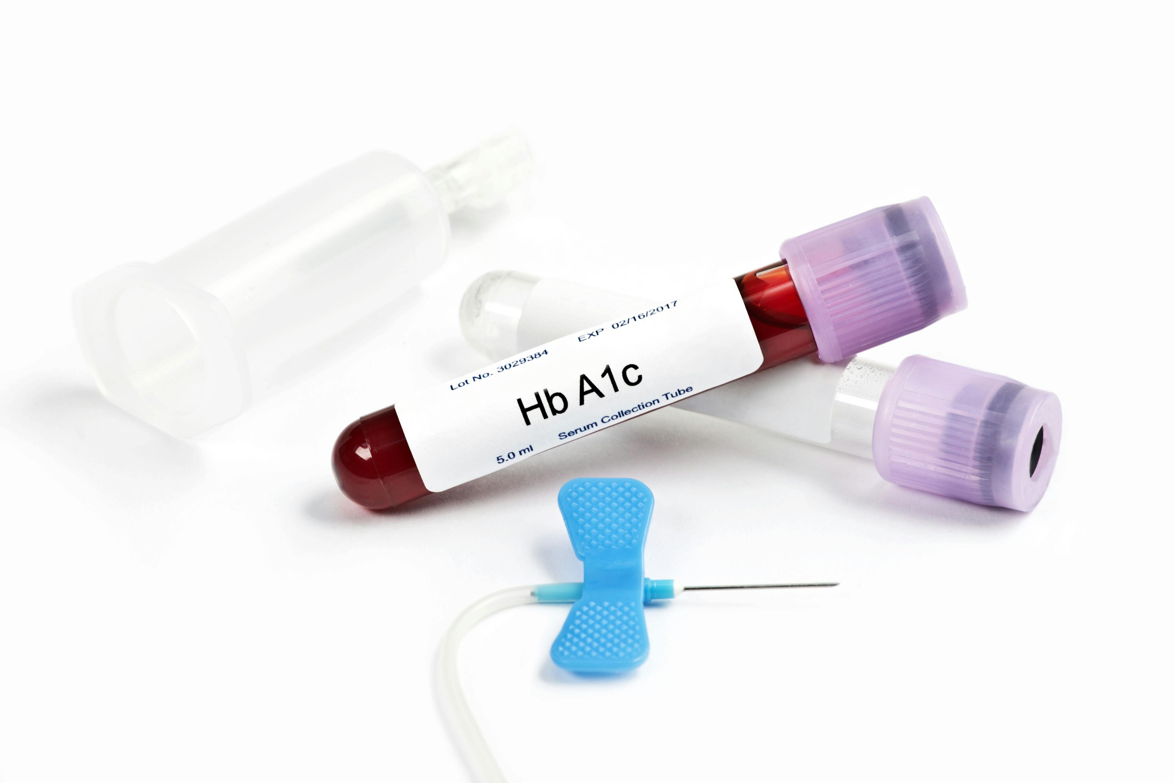 A1c Test Fails to Catch Most Diabetes Cases