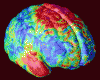 MRI Shows Lack of Grey Matter Linked to Schizophrenia and Bipolar Disorder