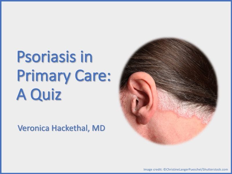 Psoriasis in Primary Care: A Quiz