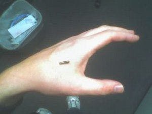 Implantable RFID: RIP?