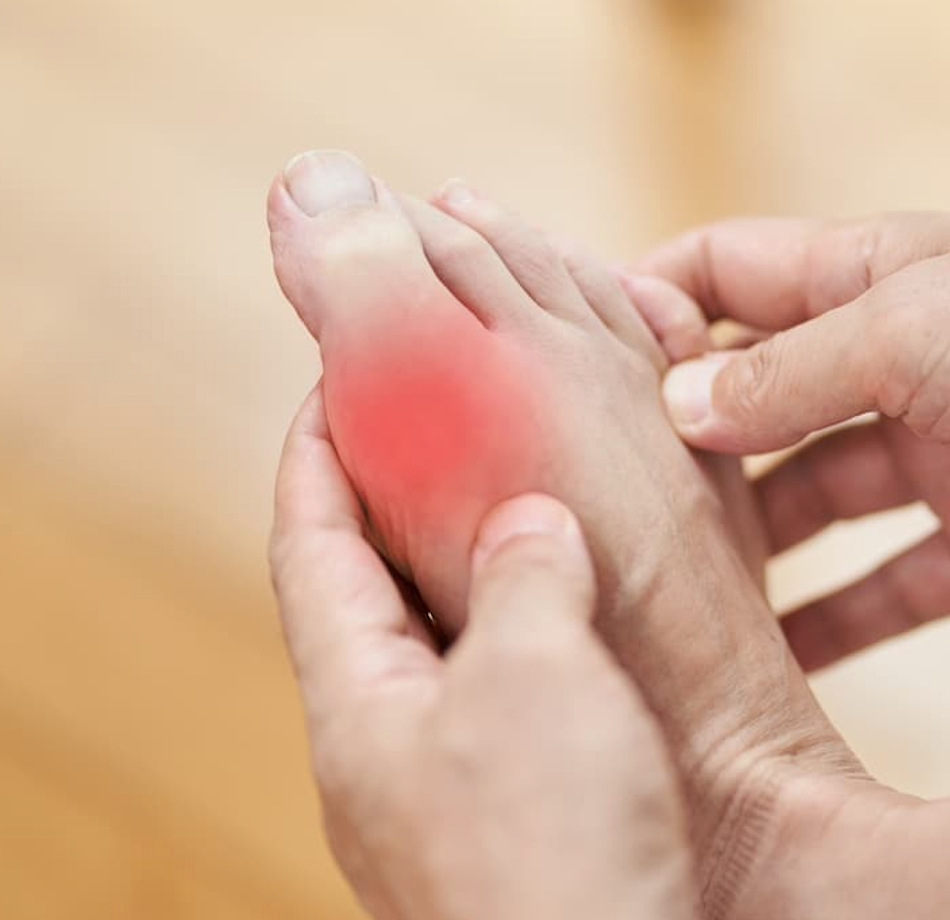 Asymptomatic Hyperuricemia Increases Risk of Arthritis