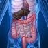 Non-Invasive Colorectal Cancer Screening Test Approved by FDA Panel 