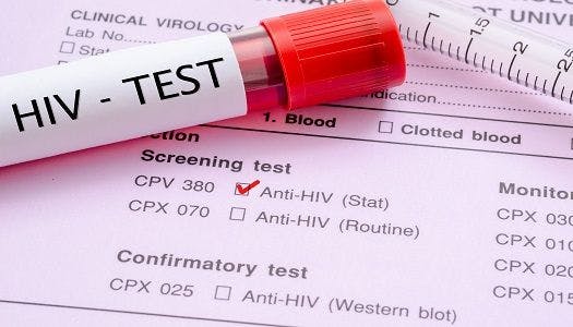 Once Daily Single-Tablet HIV-1 Therapy Achieves Primary Endpoint