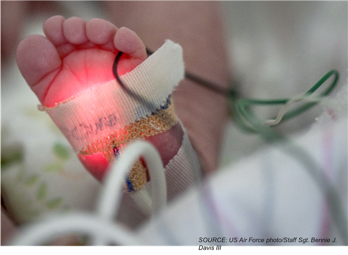 New Study Does Not Support Use of Myo-Inositol to Prevent Blindness in Premature Infants