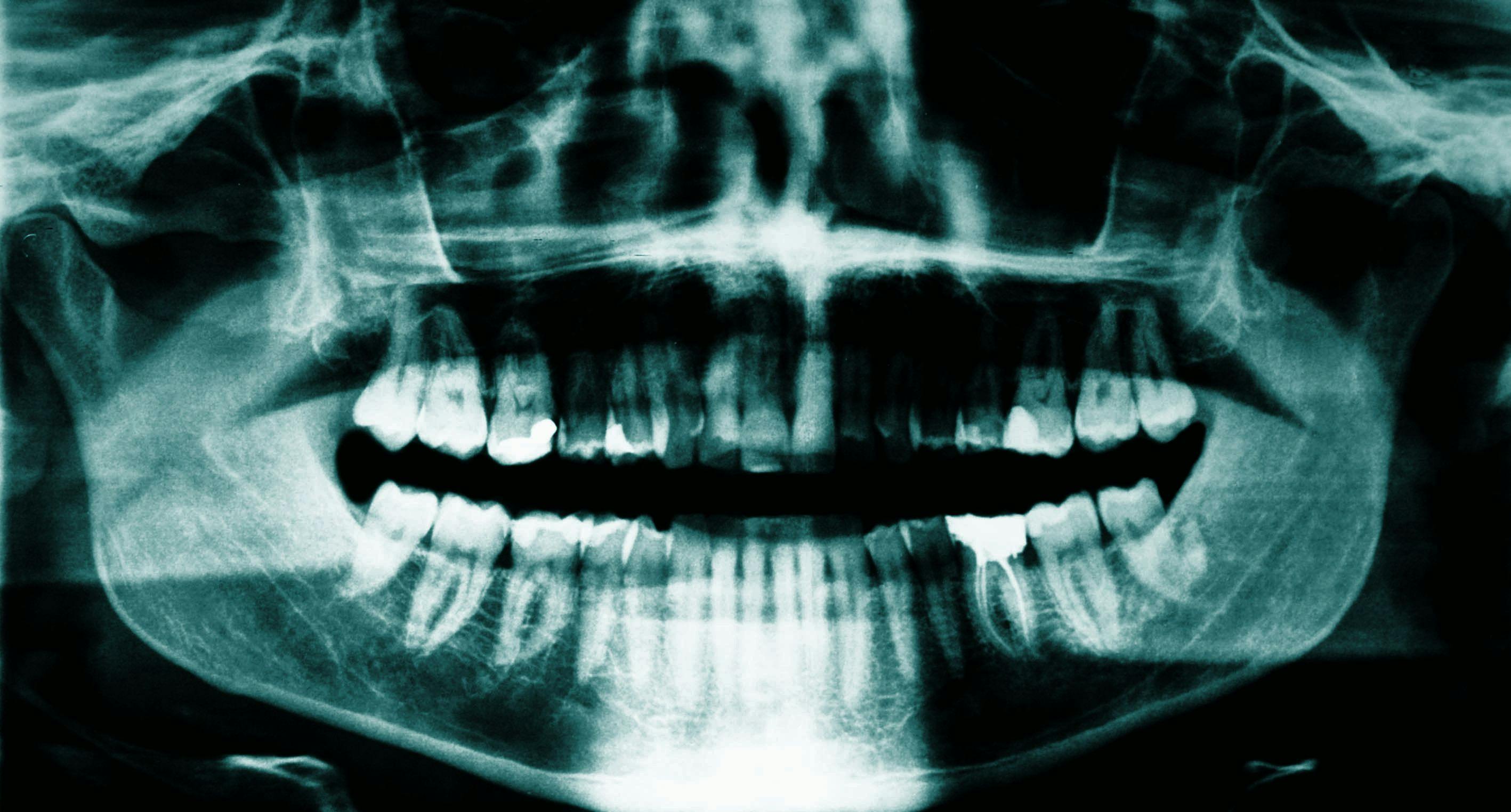 What’s next for rheumatoid arthritis-associated periodontal disease?