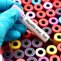 How Dual Hepatitis B, C Infection Differs from Single Infection