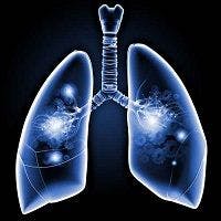 Getting Gene Info Leads Patients to Get Lung CT Scans