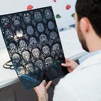 MRI Technique Could Help Diagnose CTE