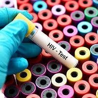 HIV Home-Test Kits Show Promise For Boosted Testing Numbers