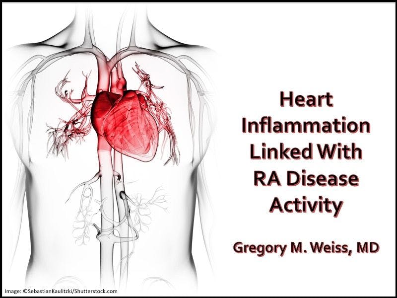 Heart Inflammation Linked With RA Disease Activity