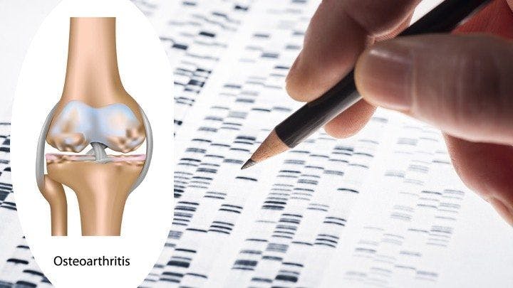 Osteoarthritis Risk Intensifies With Epigenetics