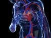 Fat Around Heart May Lead to Artery Disease