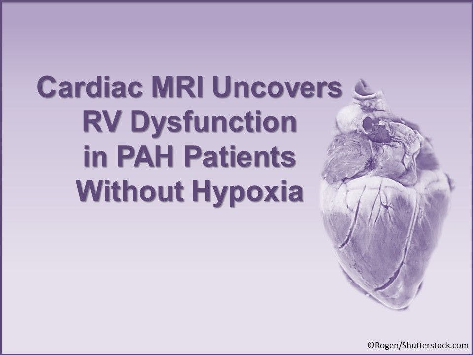 Cardiac MRI Uncovers RV Dysfunction in PAH Without Hypoxia