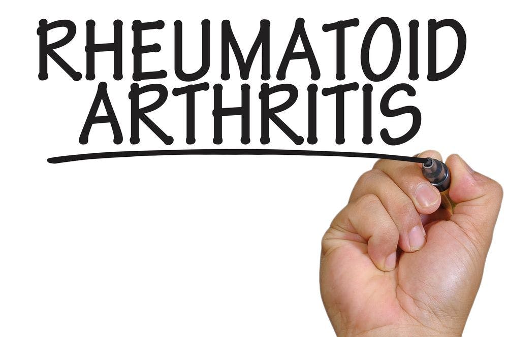three historical game changers in rheumatoid arthritis treatment