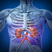 New Device Reduces Contrast-Induced Kidney Injuries