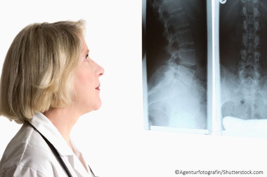 doctor woman physician x-ray spondyloarthritis ACR