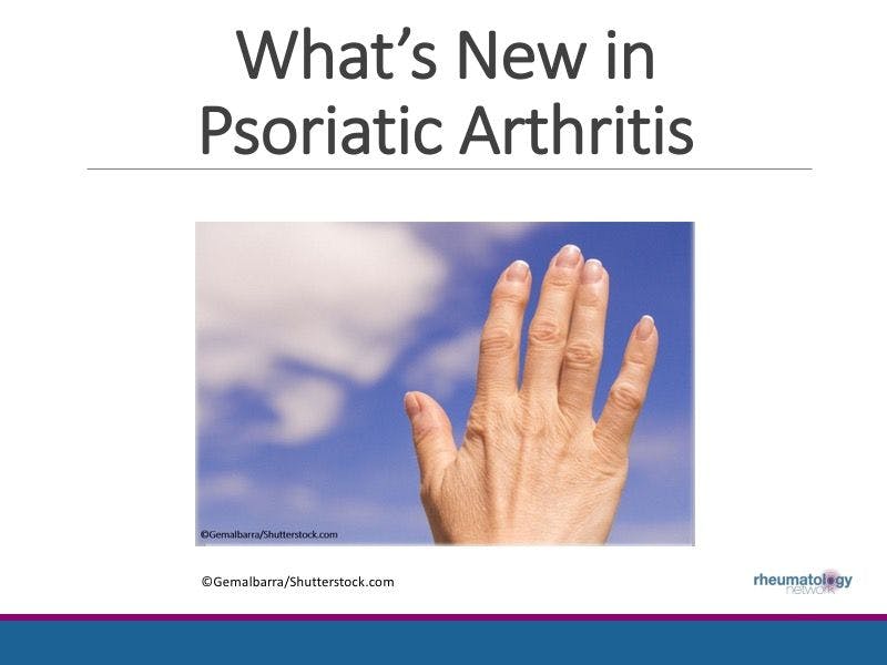 What's New in Psoriatic Arthritis