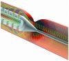 Drug-eluting Stents Safer than Bare-metal Stents for Coronary Bypass