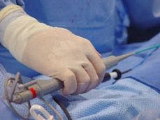 FDA Approves New Ablation Catheter to Treat Atrial Fibrillation