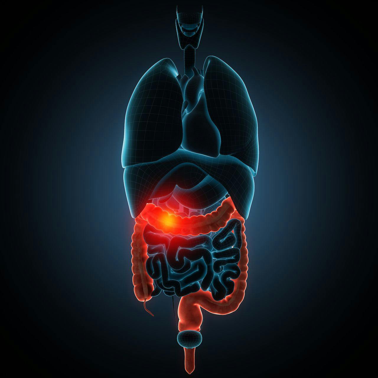 Crohns Disease Treatment, RHB-104, Yields Positive Results in Phase 3 Trial 