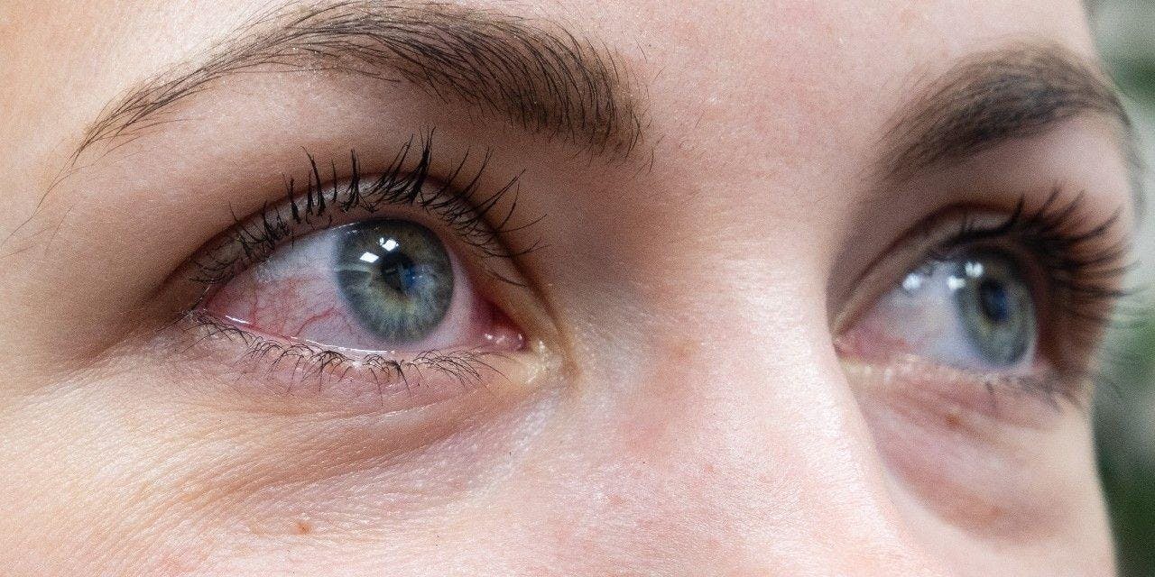 Close-up photo of a woman's eyes. 