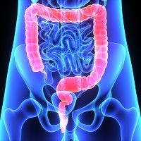 Longer Treatment with Ozanimod Shows Promise for Ulcerative Colitis