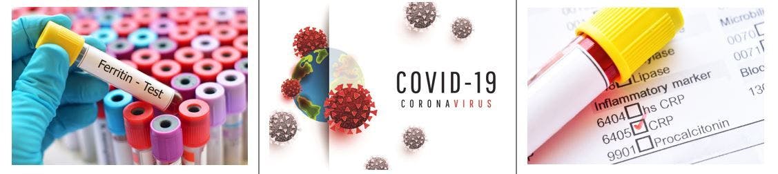 covid-19 tests