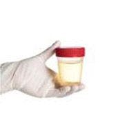 Researchers Emphasize Routine Urine Drug Testing to Ensure Opioid Compliance, Enhance Pain Care