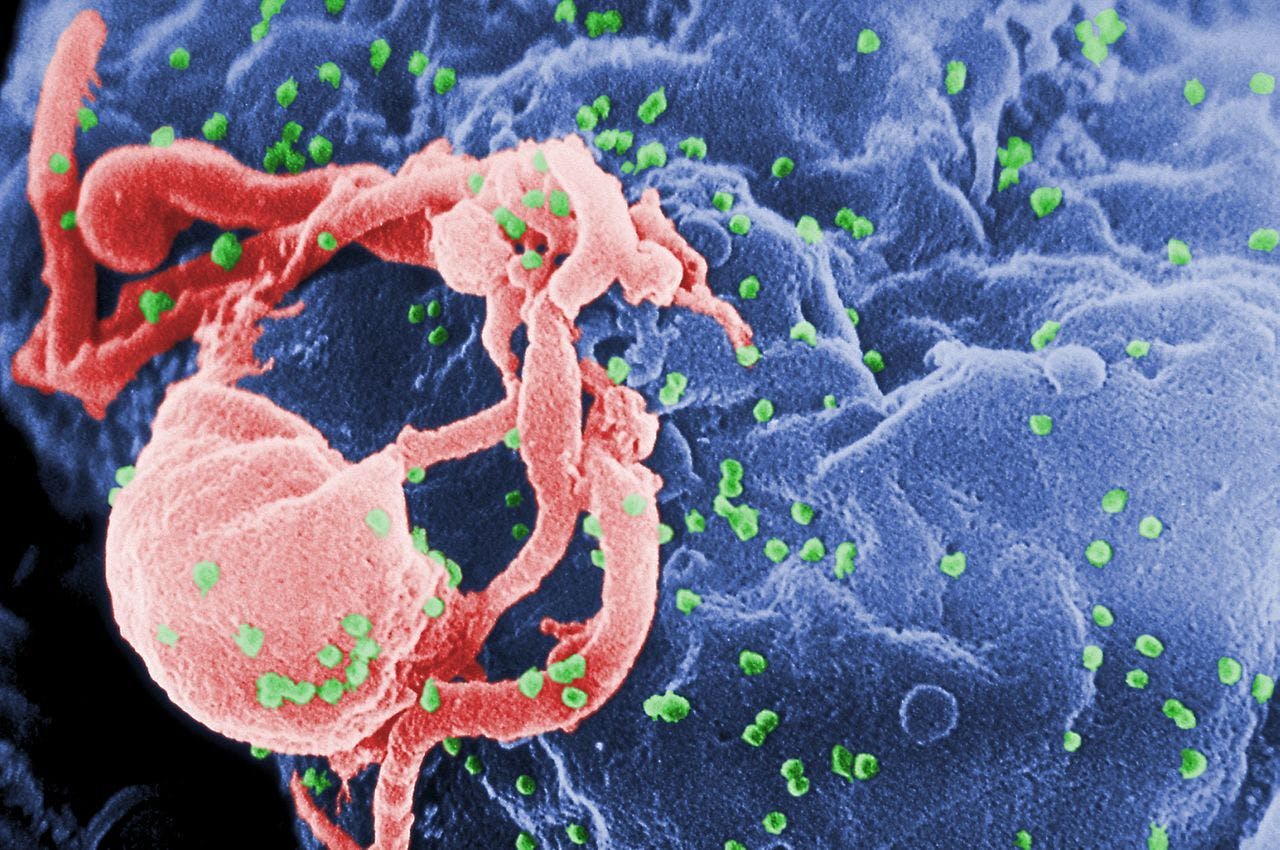 Single Value of HIV Overvalues Viral Suppression