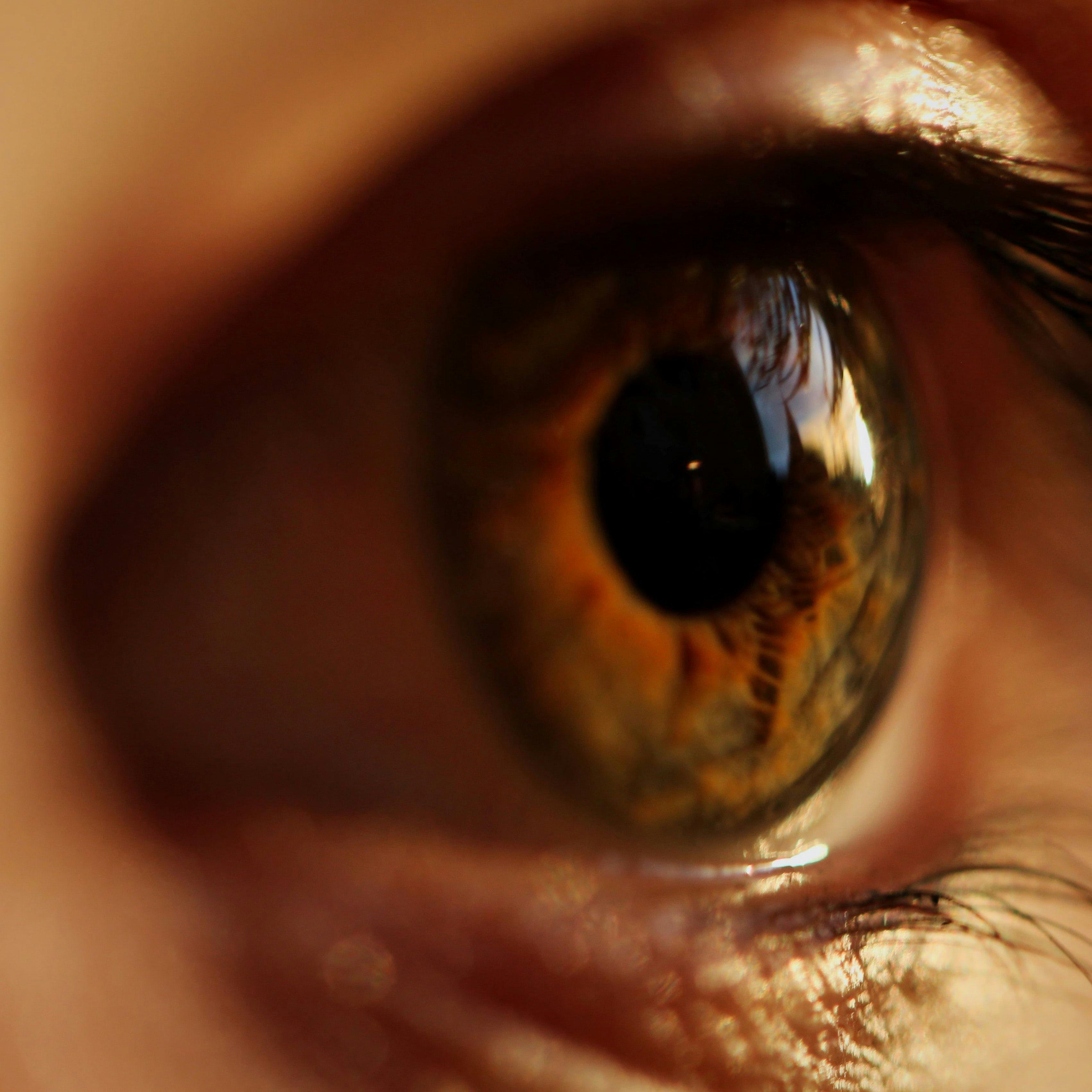 Anti-VEGF Drugs Do Not Differ in RPE Tear Risk for Wet AMD Eyes