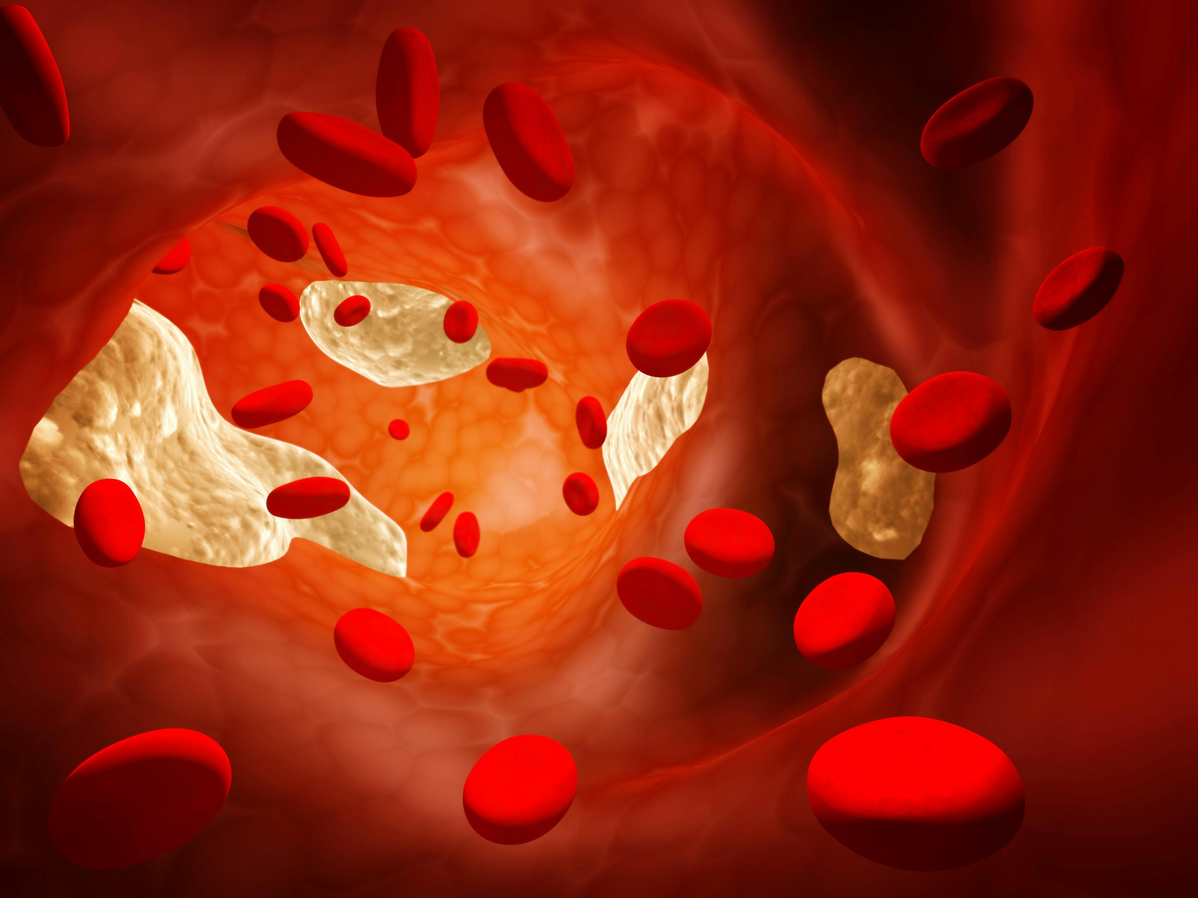 An illustration of cholesterol in the blood stream. 