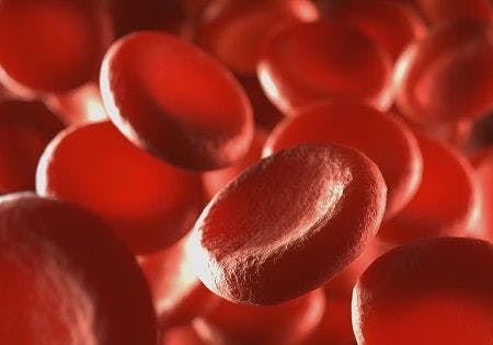 Increased AFib, Major Bleeding with Ibrutinib for Hematologic Malignancies