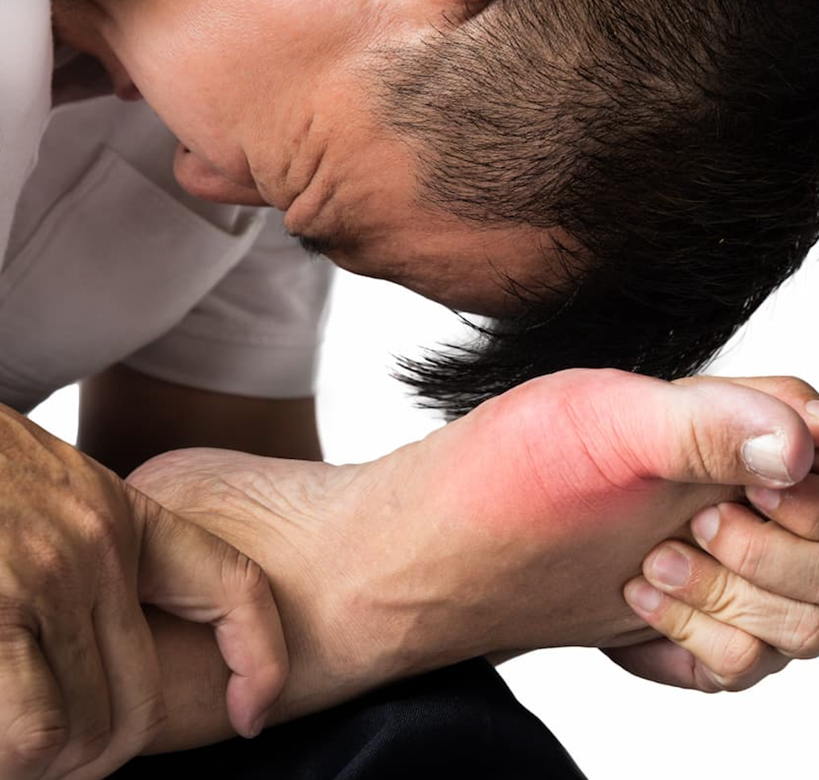 TCMD gout therapy 