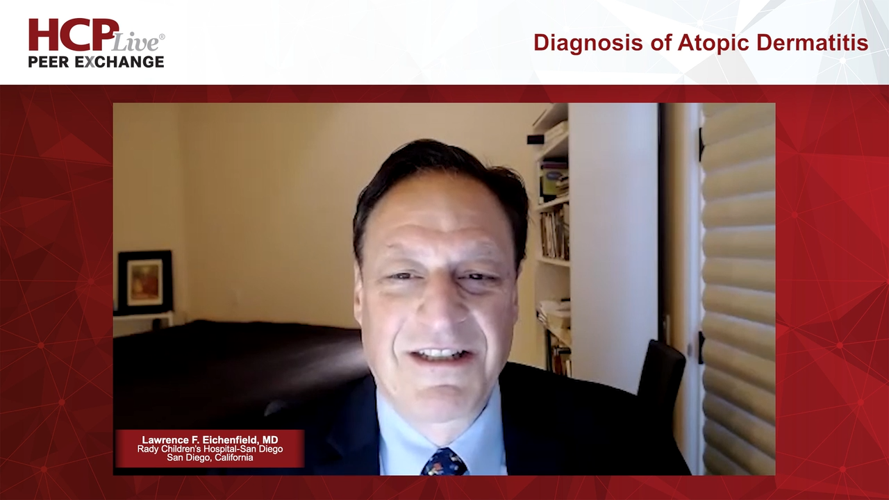 Diagnosis of Atopic Dermatitis 