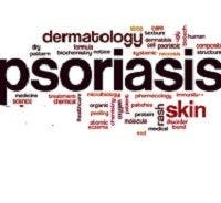 With Age Comes Reduced Treatment Access for Psoriasis Patients
