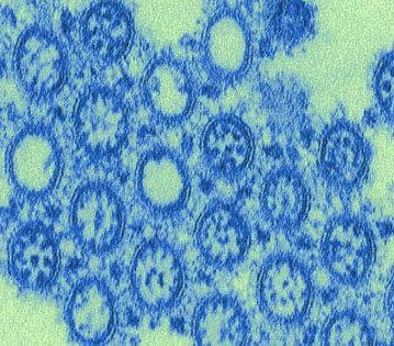 Investigators Compare Antivirals for H1N1 Influenza